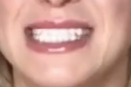 Big Smile Sample
